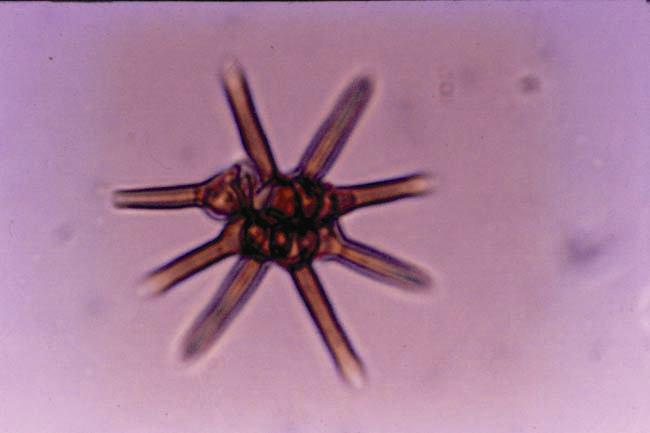 A photograph of an eight-armed fungal species discovered by CV Subramanian.
