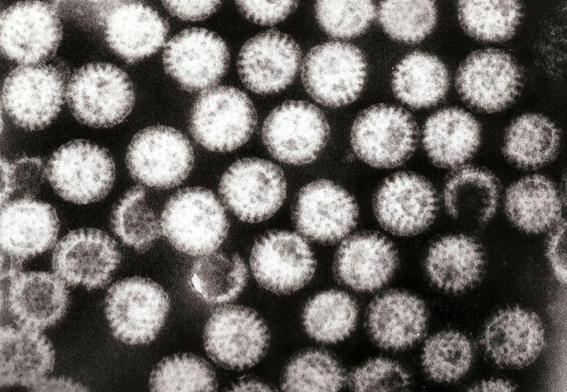 Photograph of rotavirus particles.
