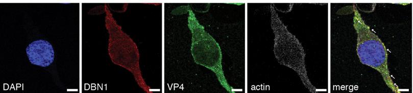 Photographs of DBN1 interacting with actin.
